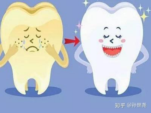 龋齿和冠周炎区别（智齿和龋齿有什么区别）这些你应该知道！(图1)